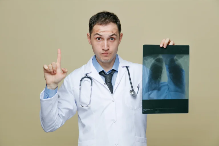 Impressed young male doctor wearing medical robe stethoscope around neck looking camera showing xray shot pointing up isolated olive green background