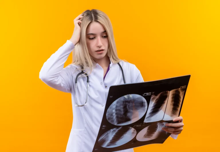 Thinking doctor young girl wearing stethoscope medical gown holding x ray put her hand head isolated yellow wall