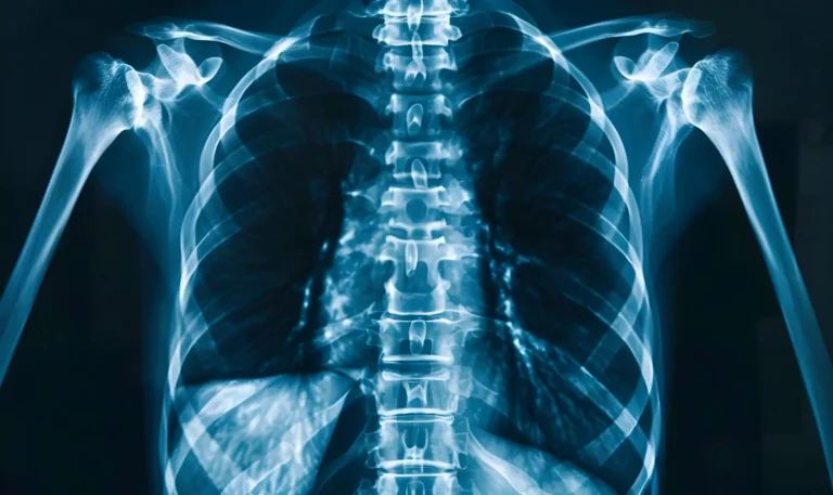 World radiography day background design